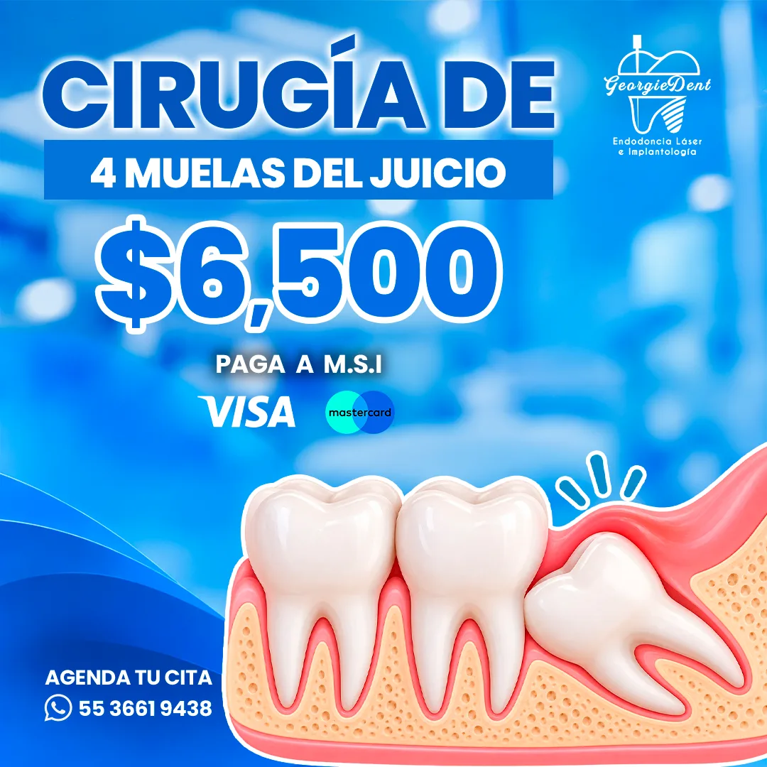 Promoción cirugía de 4 muelas del juicio por $6,500